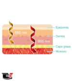 Cinturón láser lumbar-abdominal