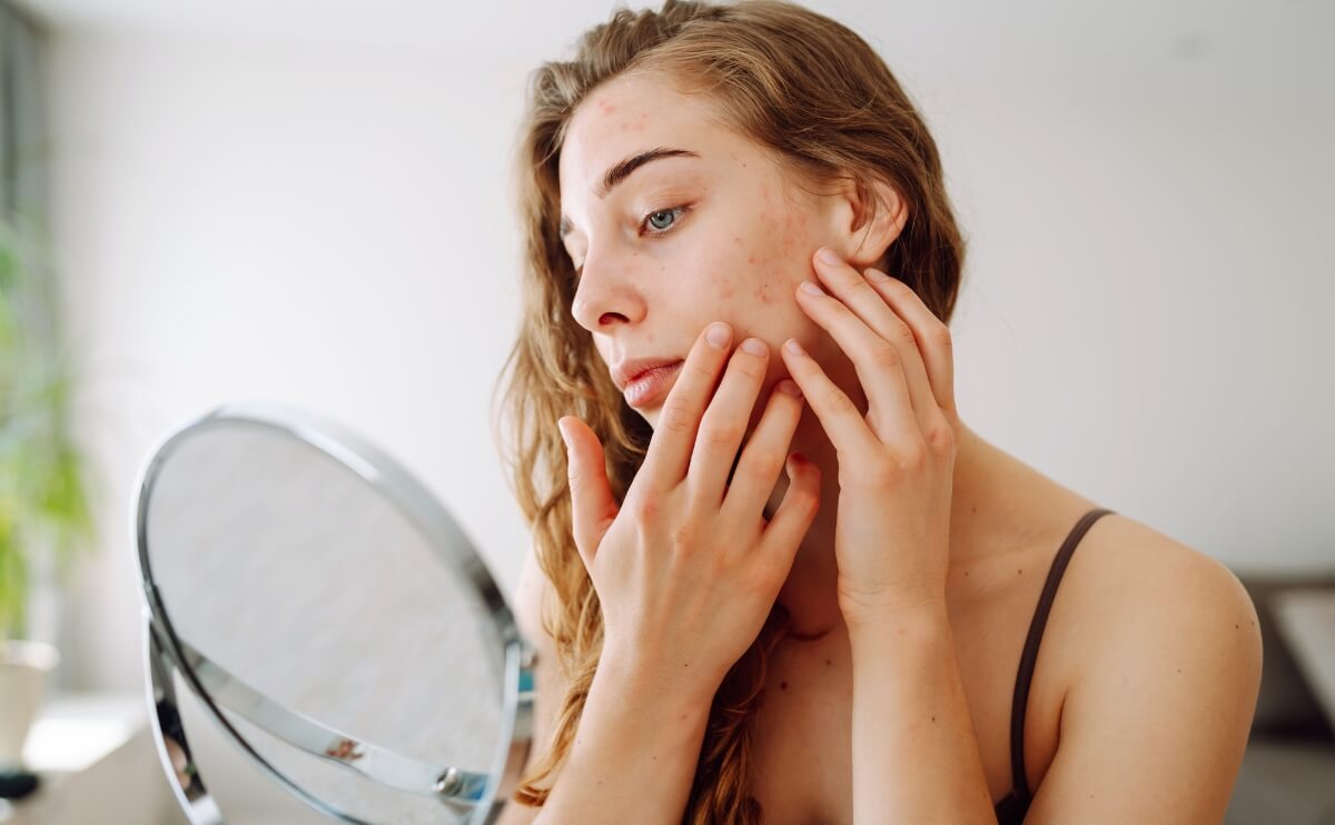 Cómo Cuidarnos para Mantener una Piel Sana